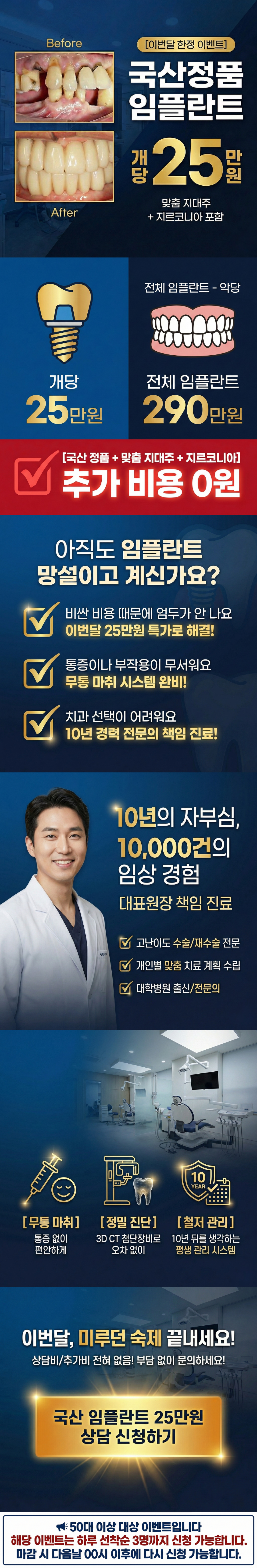 임플란트 상담 신청